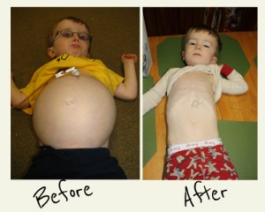 matthew before & after